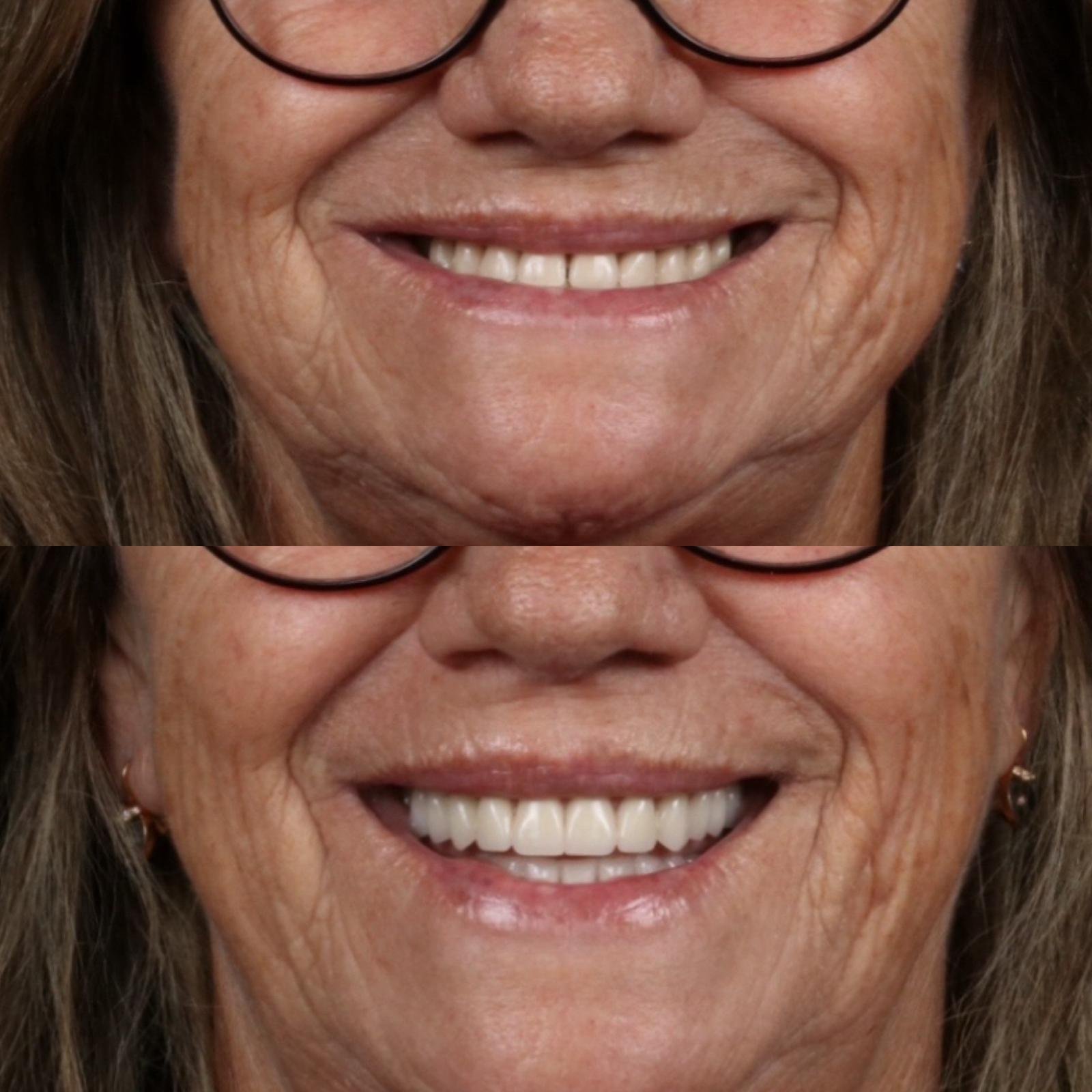 Tratamiento odontología general 1